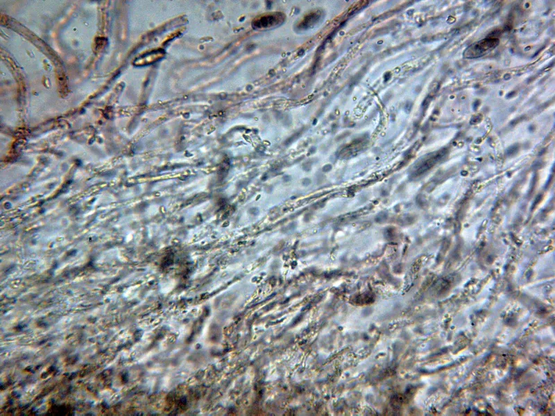 Chroogomphus rutilus 10 - Suprapellis x 400